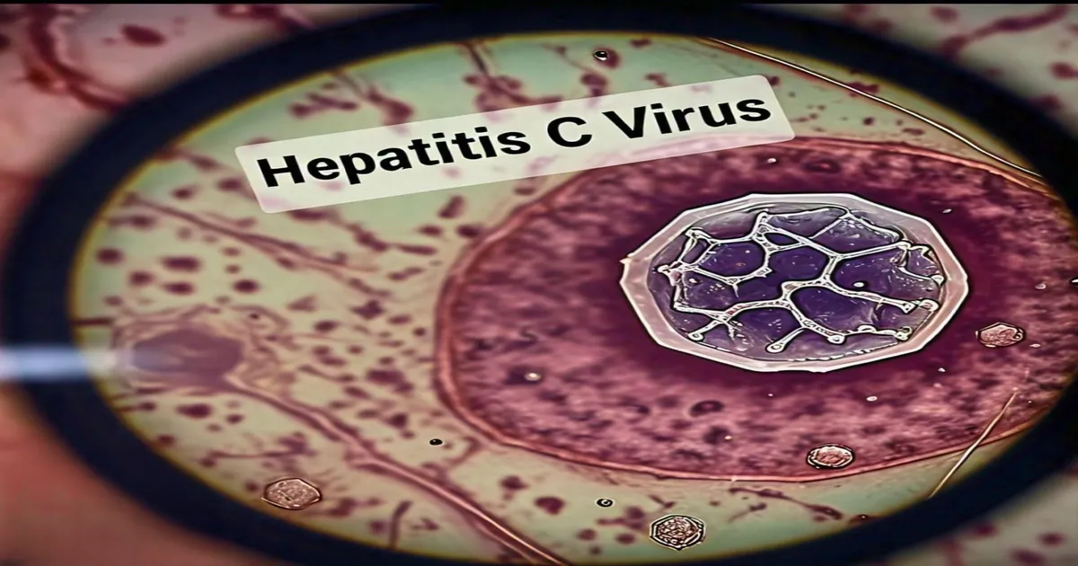 Understanding Hepatitis C